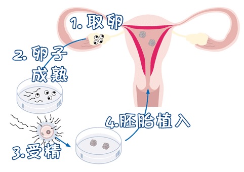 关于{ k1=g1 }